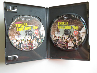 THIS IS ENGLAND '90 - 2 DISCS (DVD) VICKY MCCLURE JOE GILGUN 2015 REGION 2
